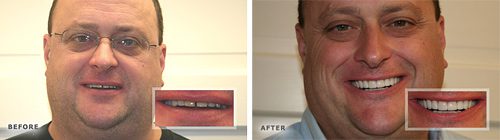 Cosmetic Dentistry Before and After Photos