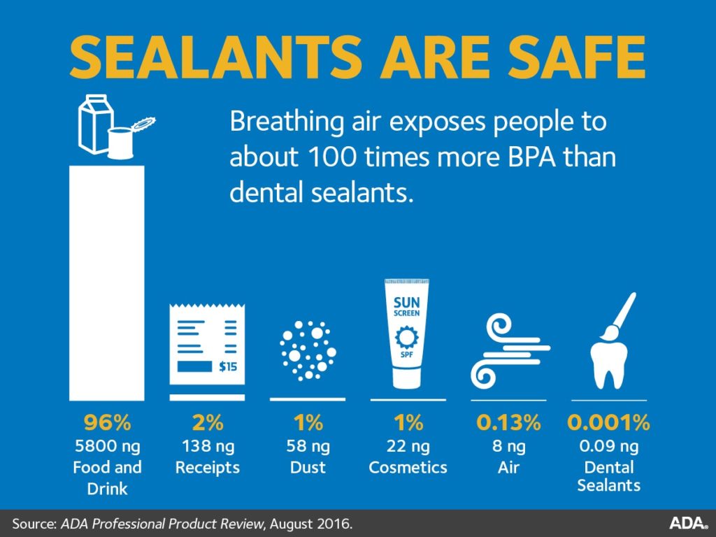 Seal Out Tooth Decay dental sealants