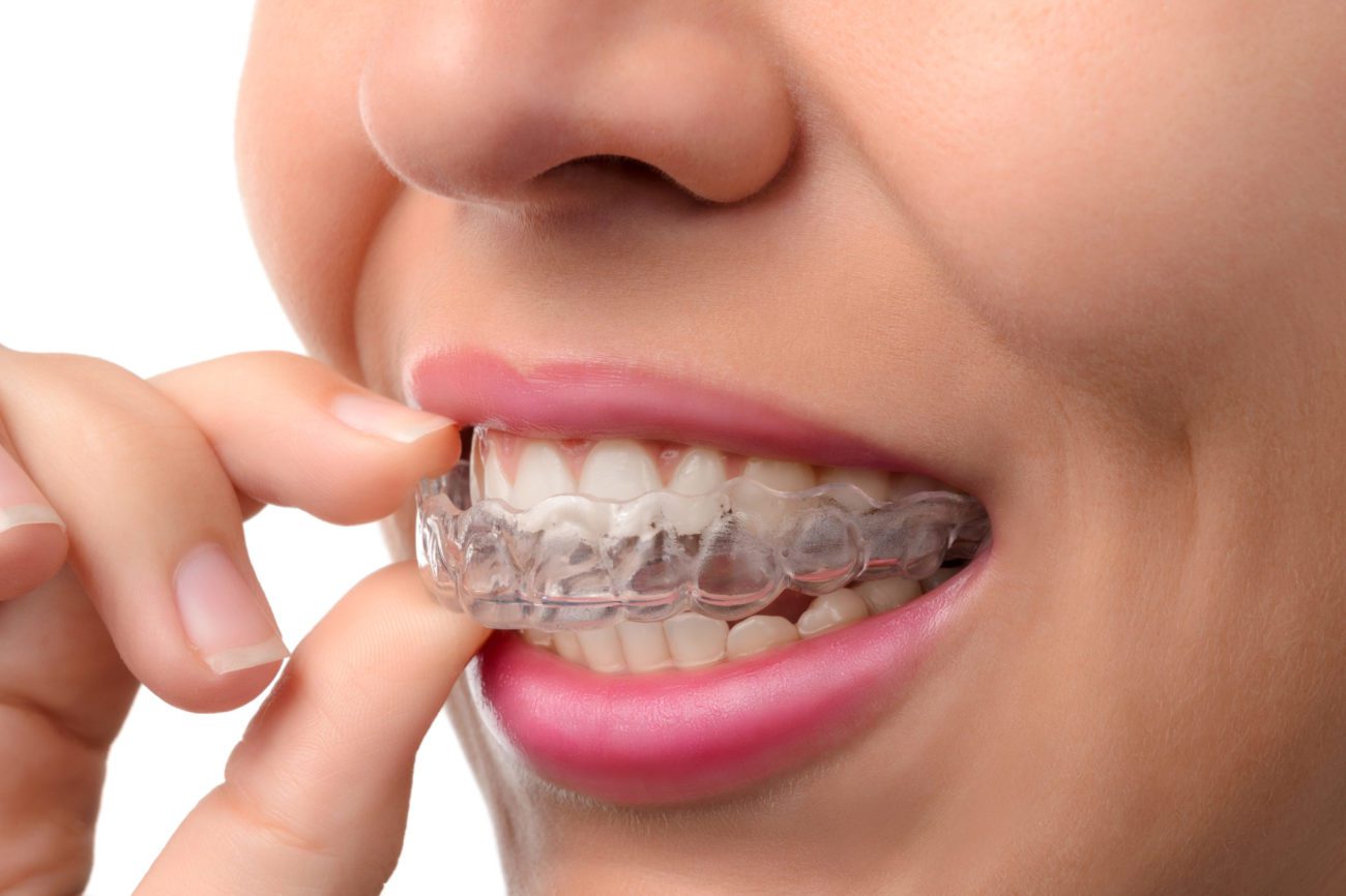 Woman wearing Invisible Braces clear aligners northborough ma