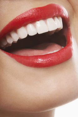 getting porcelain veneers in Northborough Massachusetts
