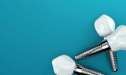 affordable dental implants in northborough, massachusetts