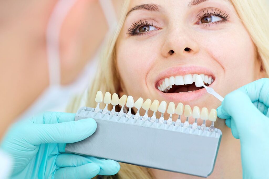 oral health benefits of porcelain veneers