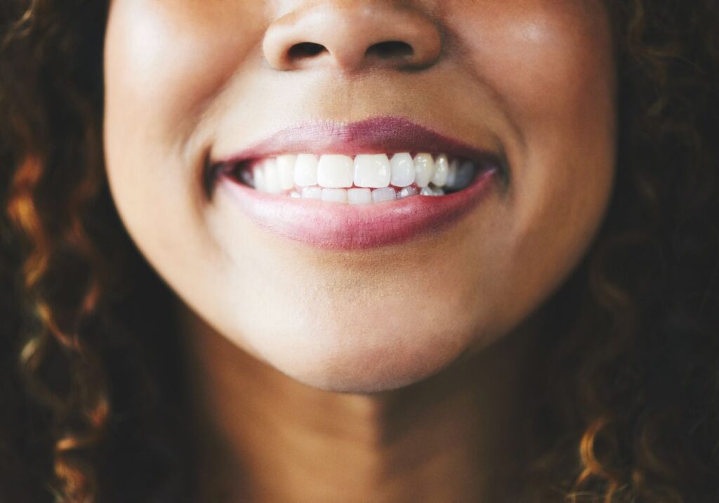 preserve teeth whitening treatment benefits
